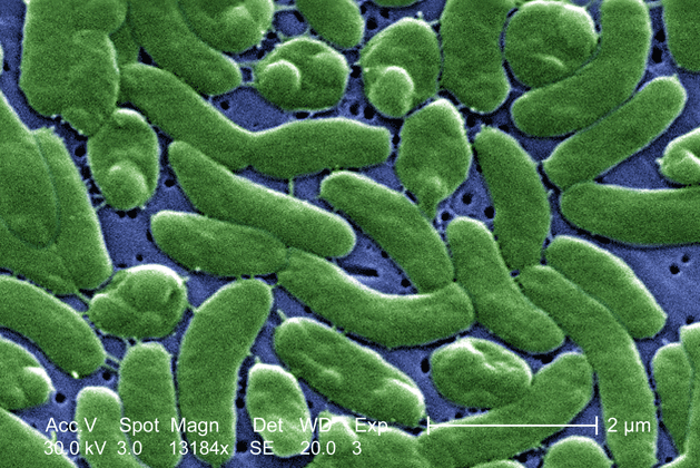Vibrio vulnificus bacteria