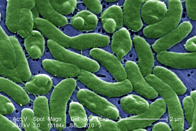 vibrio cholerae bacteria