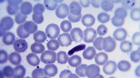 This Giemsa-stained, thin film blood smear photomicrograph reveals the presence of a young, growing, Plasmodium vivax trophozoite (Lt), and a platelet stack (Cntr), which resembles a P. falciparum gametocyte.