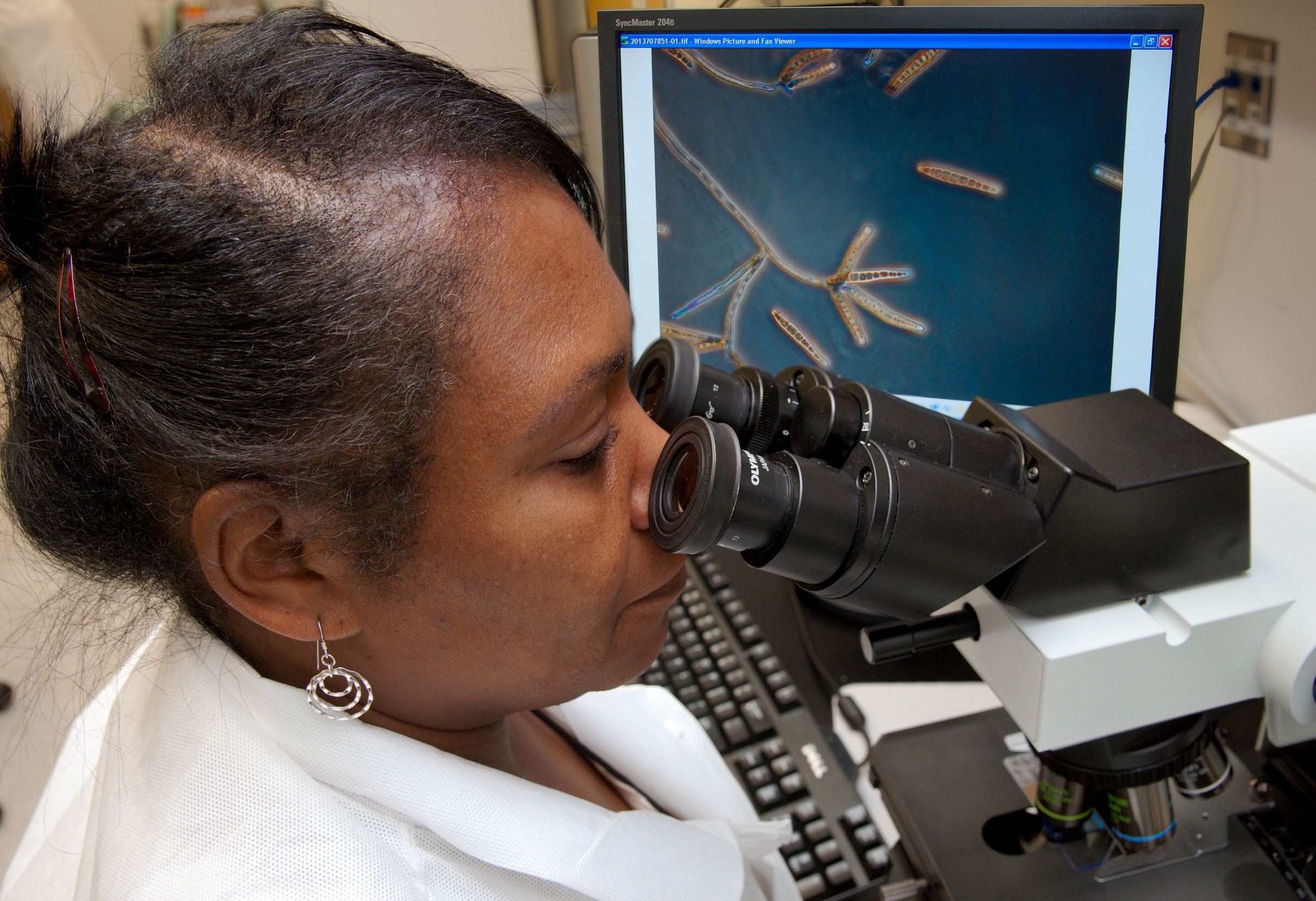 CDC scientist looks through microscope at fungus displayed on screen