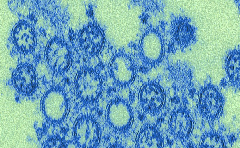 This highly magnified transmission electron microscopic (TEM) image depicted numbers of virions from a novel influenza H1N1 isolate.
