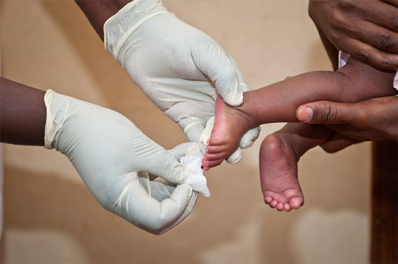 A healthcare worker takes a dried blood sample (DBS) from an infant's foot in Mwanza to test the infant for HIV.