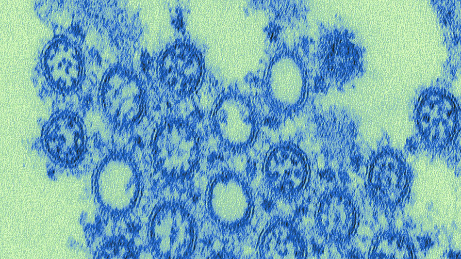 This highly magnified transmission electron microscopic (TEM) image depicted numbers of virions from a novel influenza H1N1 isolate. 