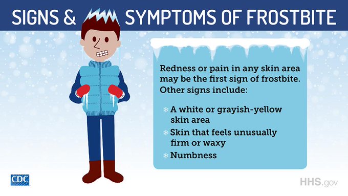 Signs and Symptoms of Frostbite